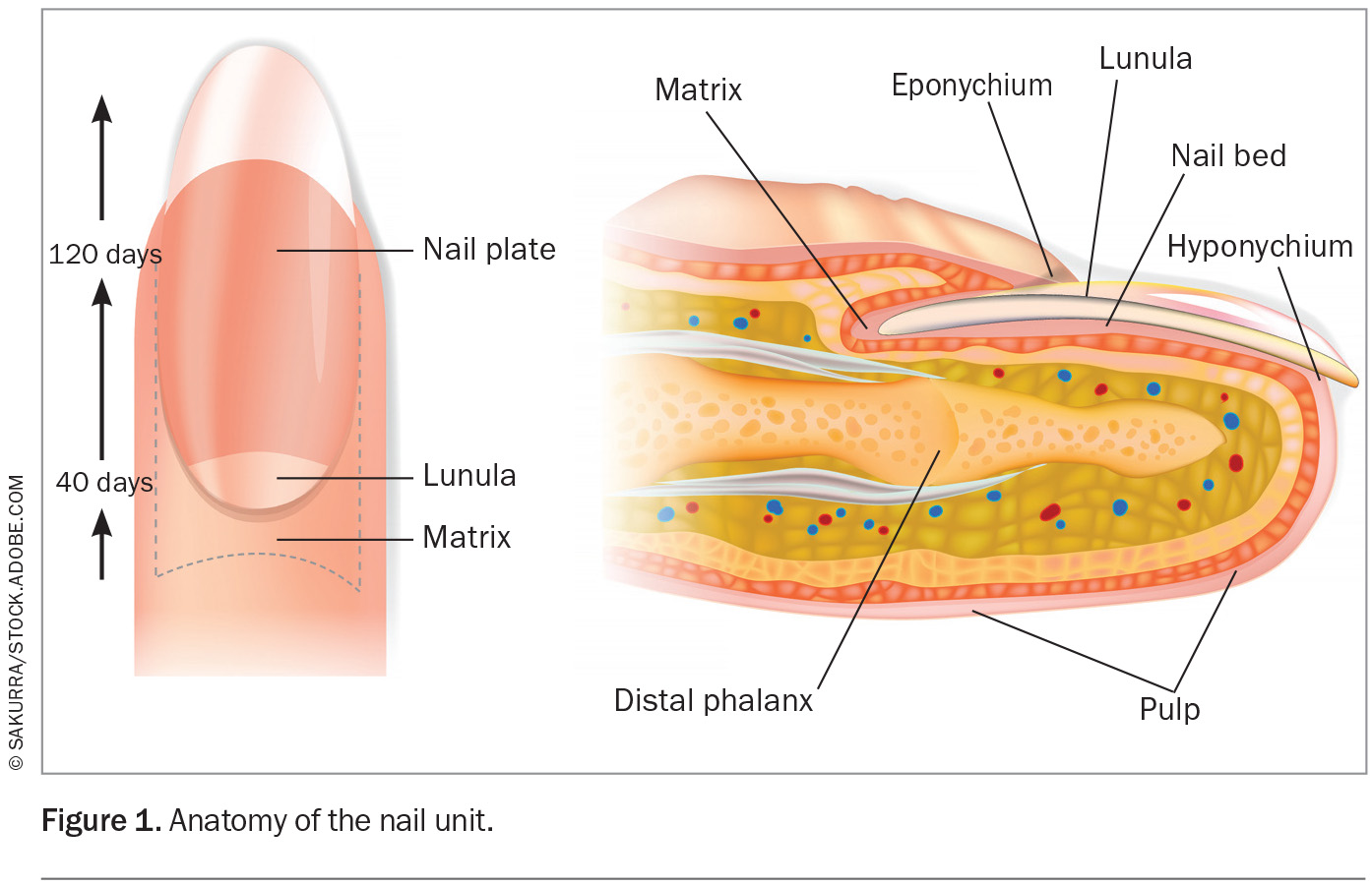 evaluation-and-management-of-nail-diseases-medicine-today